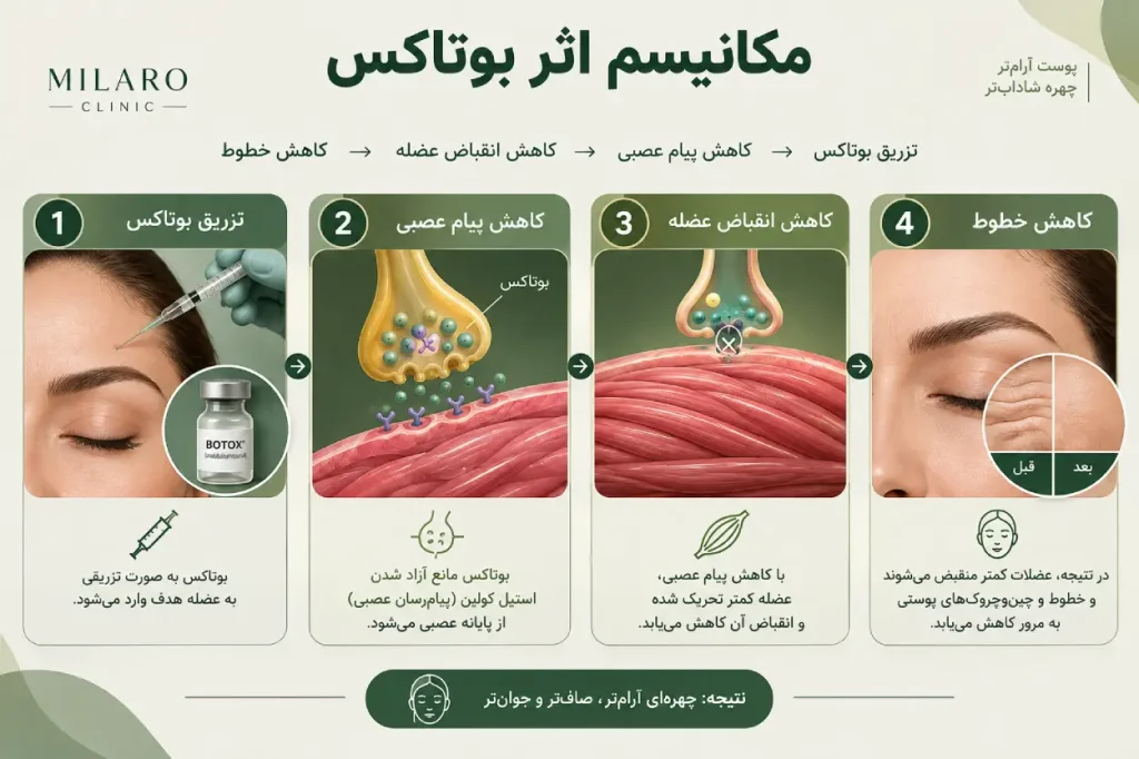 نحوه انجام بوتاکس پیشانی 