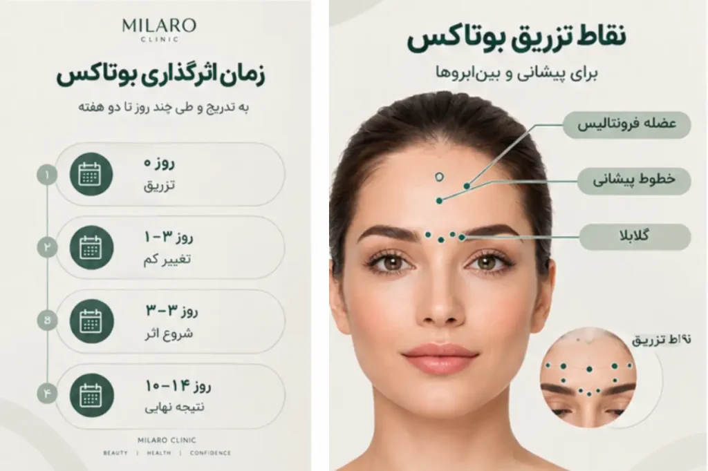 نقاط تزریق و زمان انجام و اثرگذاری بوتاکس پیشانی